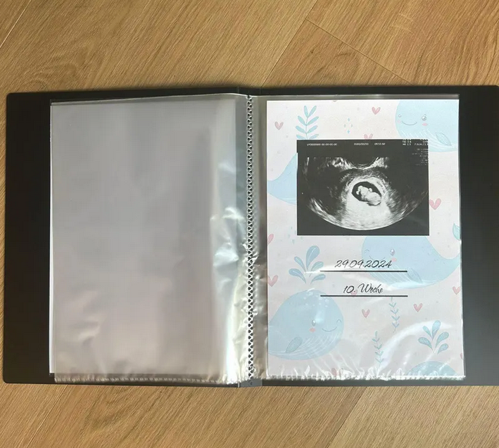 Aufgeschlagenes Ultraschallalbum mit eingeklebtem Ultraschallbild, Datum und Schwangerschaftswoche – Wal-Motiv