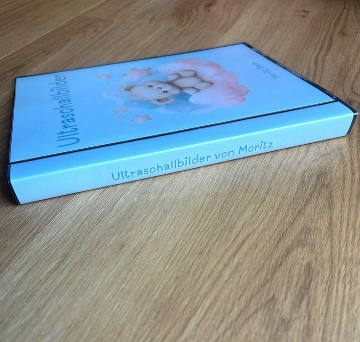 Seitenansicht Ultraschallalbum im Wolkendesign "Moritz" im stabilen Hardcover