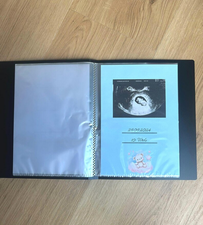 Aufgeschlagenes Ultraschallalbum mit eingeklebtem Ultraschallbild, Datum und Schwangerschaftswoche – Teddybären-Motiv