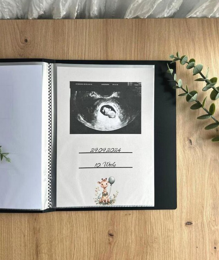 Aufgeschlagenes Ultraschallalbum mit eingeklebtem Ultraschallbild, Datum und Schwangerschaftswoche – Giraffenmotiv