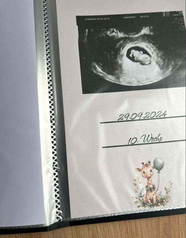 Einblick in das Ultraschallbild Album mit der Giraffe