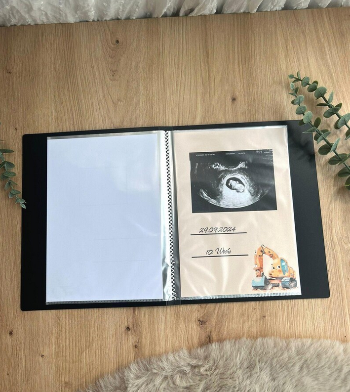 Personalisierbares Ultraschallalbum Bagger Design – FamilieGlueck